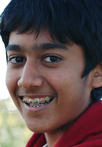 traditional braces